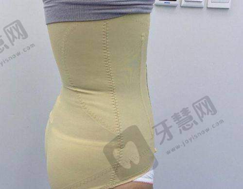 北京副乳吸脂十大排医生院——北京京美医疗美容