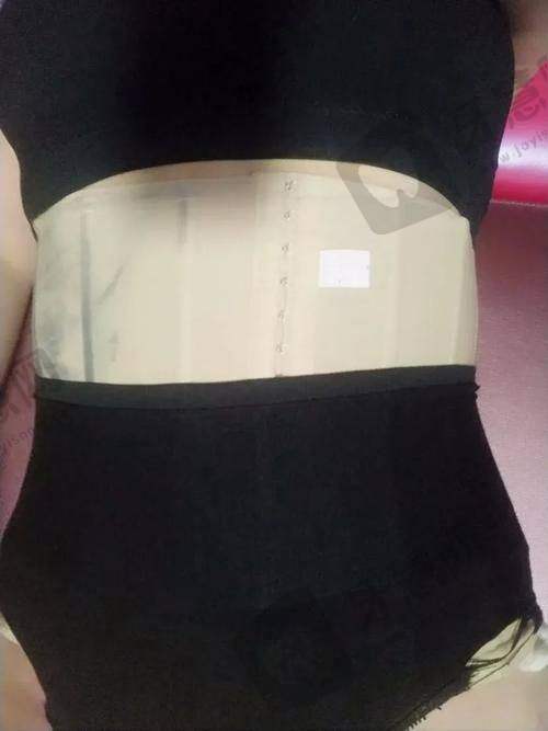 北京背部吸脂排名前十——北京纯脂整形
