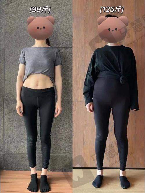 北京富贵包吸脂排名前十——北京达美如艺医疗美容