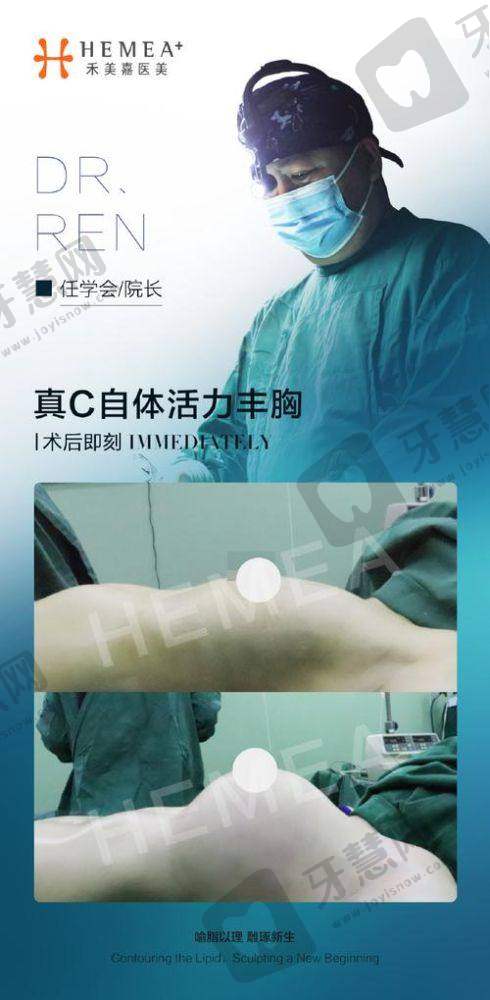 北京脂肪胶丰胸前十的医院公布——北京美莱医疗美容医院