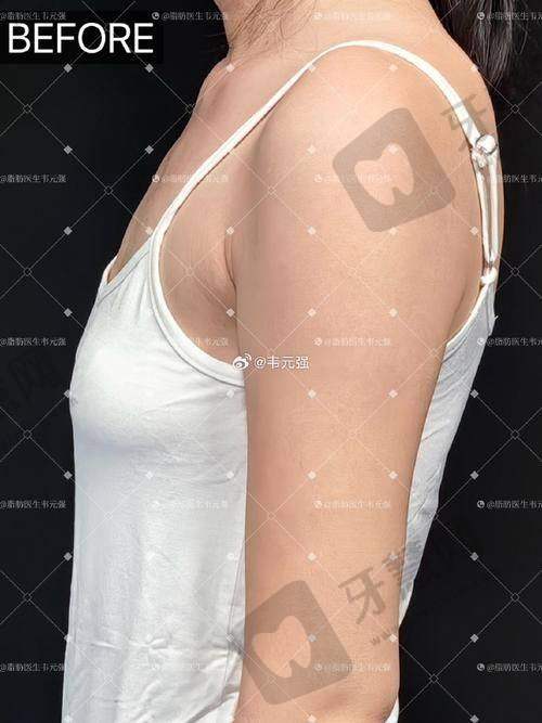 北京乳房下垂矫正十大排名医院（2025）美莱/韩啸等医院及医生推荐