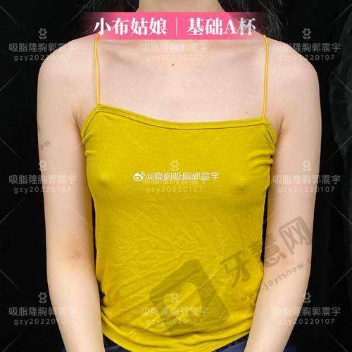 北京乳头缩小前十的医院公布——北京联合丽格第1医疗美容医院