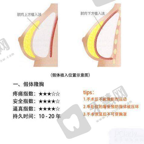 北京乳头缩小前十的医院公布——北京艺星整形美容医院