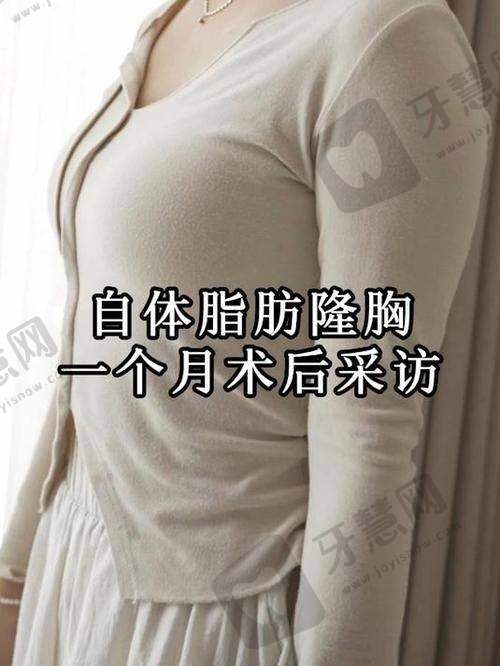 北京脂肪胶丰胸前十的医院公布——北京京韩