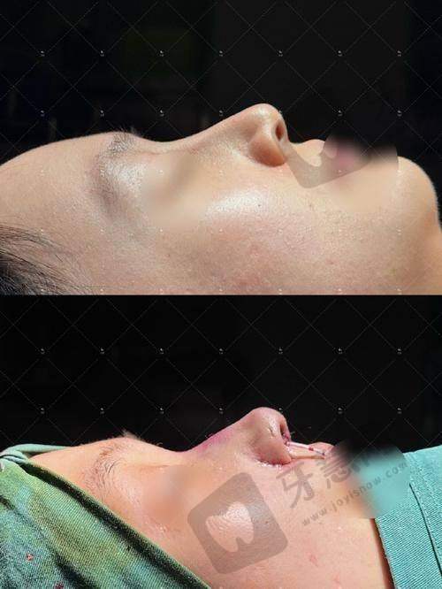 北京鞍鼻矫正前十的医院——北京张海明整形美容门诊部