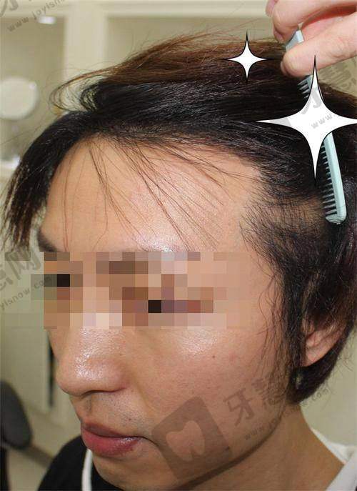 北京百达丽美容皮肤软组织扩张 43750 元起之项目简介
