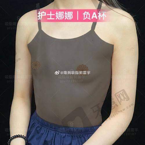 北京乳头缩小前十的医院公布——北京圣嘉新医疗美容医院