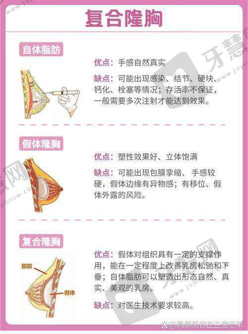 北京乳头缩小前十的医院公布：高超/王明利医生擅长及6500元起价格