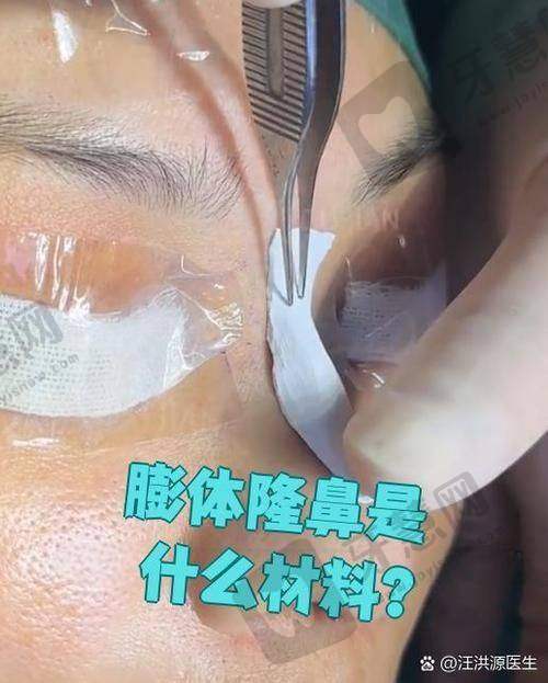 北京朝天鼻矫正十大排医生院——北京中加科洋