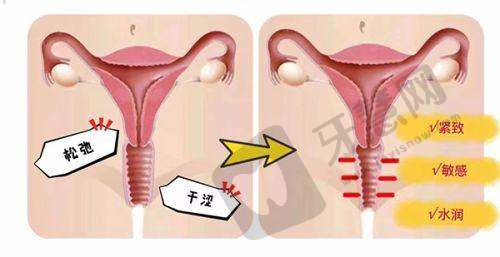北京莫娜丽莎注射法定认证医院十大排名——北京画美医疗美容医院
