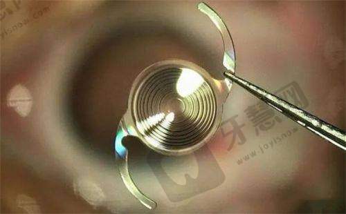 广州视可佳眼科门诊部口碑评价：