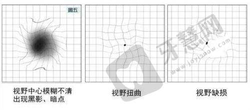 南宁爱尔眼科东葛门诊部正规吗?