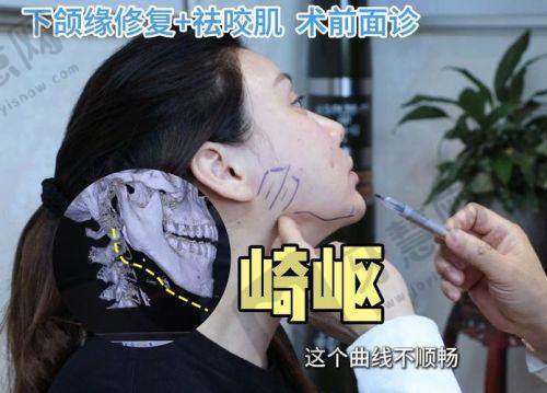 北京舒颜注射法定认证医院十大排医生院——北京米扬丽格医疗美容