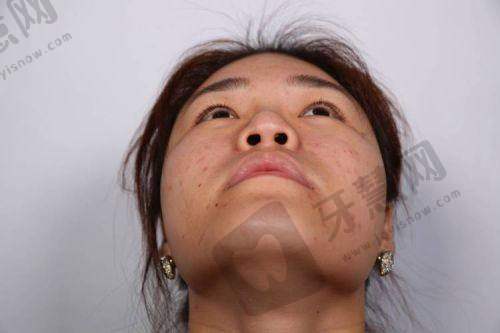 北京姣兰注射法定认证医院十大医院——北京圣嘉新医疗美容医院