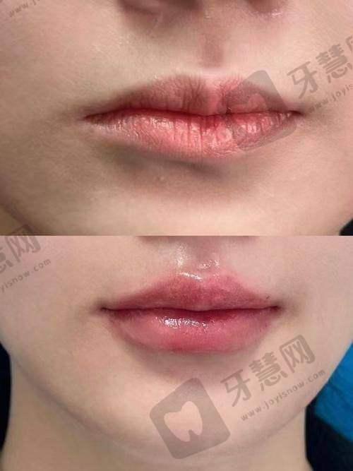 北京姣兰注射法定认证医院十大医院——北京联合丽格医疗美容医院