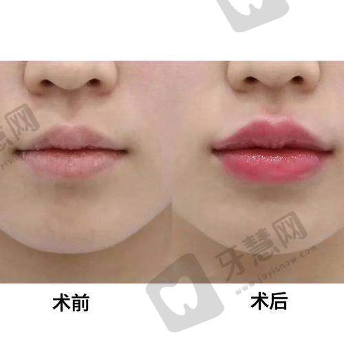 北京姣兰注射法定认证医院十大医院——北京知音医疗美容门诊部