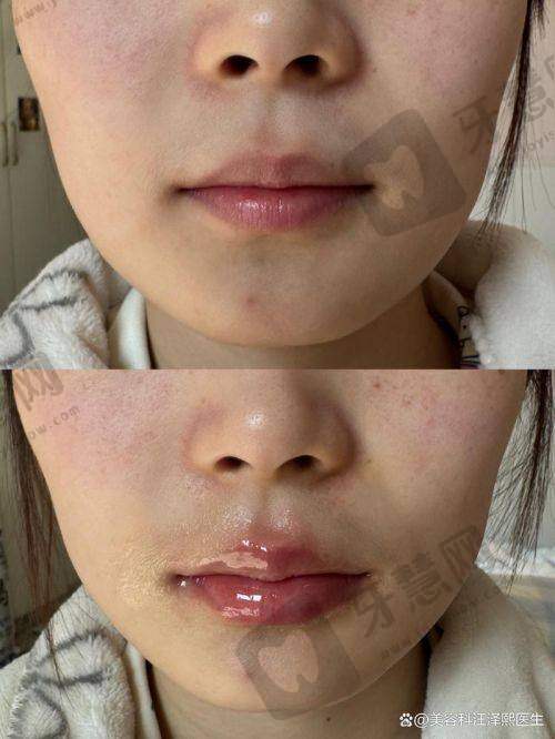 北京芙媄登注射法定认证医院——北京协和医院 - 整形美容外科