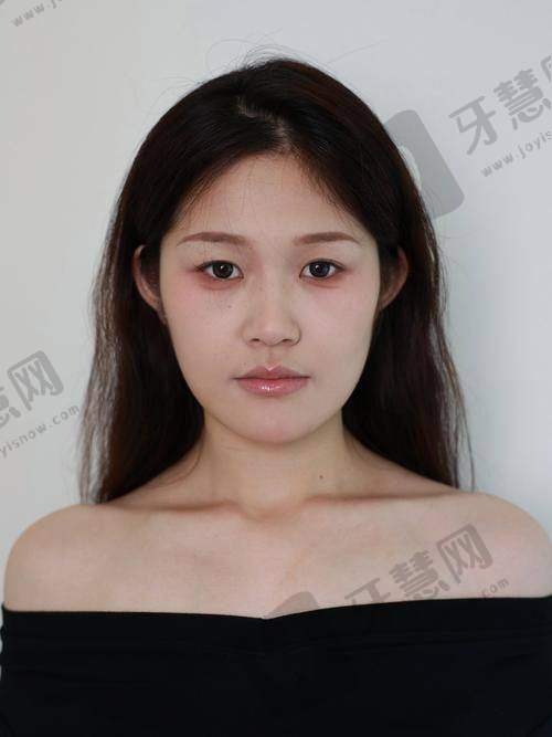 杨永成医生的口碑评价及反馈内容