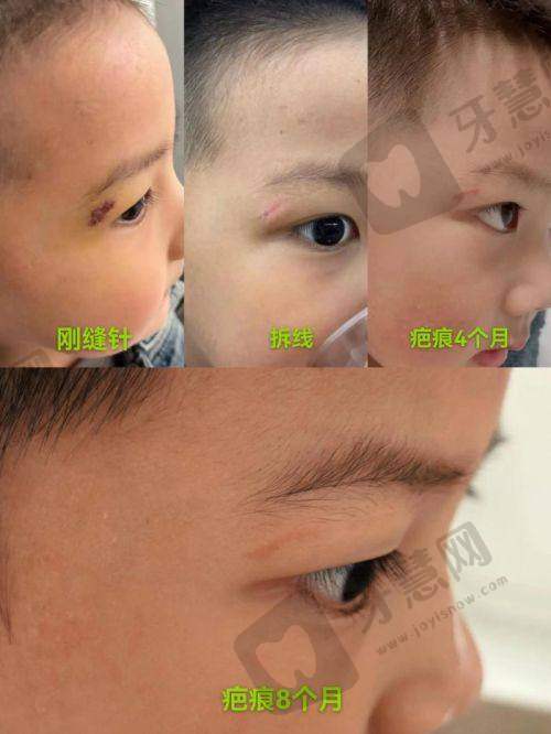 北京欣菲聆注射法定认证医院——北京嘉禾医疗美容医院