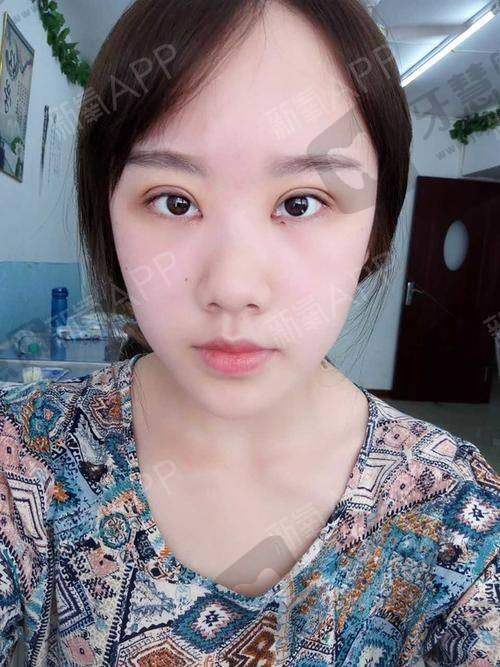 朱红振医生的技术优势