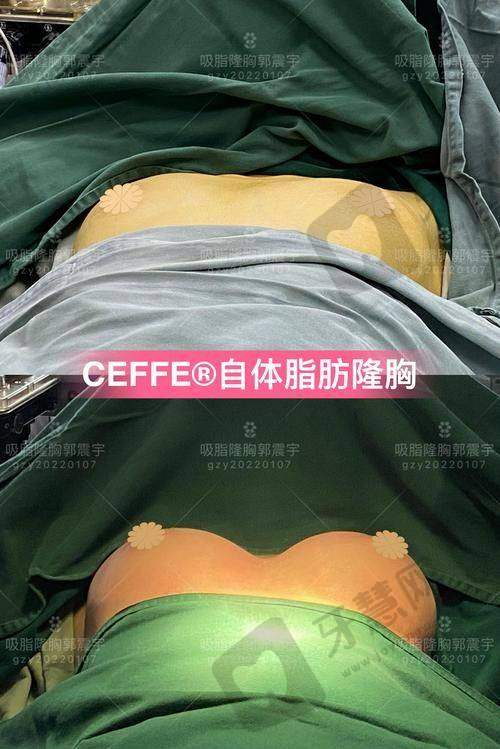 杨永成医生的个人资料简介