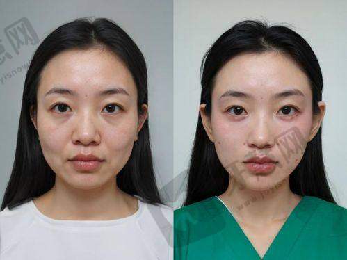 王子刚医生的擅长项目：抗衰注射领域专长