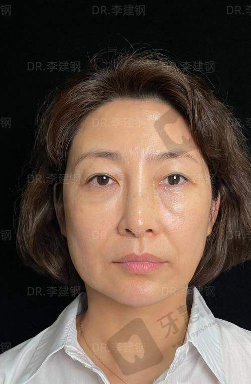 杨永成医生的技术优势