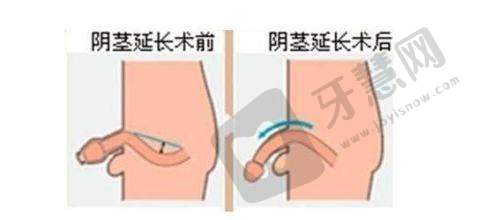 哈尔滨欧华医疗美容诊所价格表