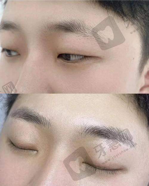 汕头紫馨整形医院项目特色