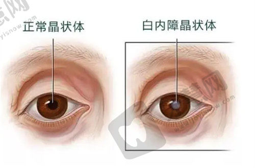 近视手术价格揭秘，附长沙蓝猫/南宁某院/徐州二院等便捷挂号与时间查询
