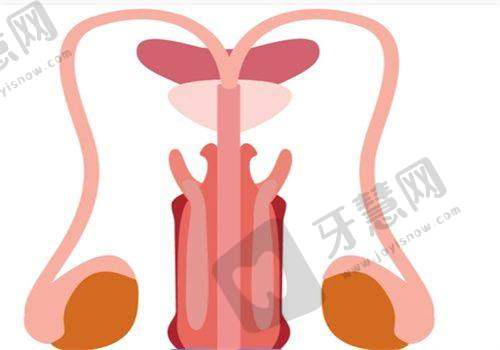 影响强生蓝钻鱼骨线价格的因素