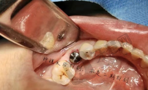 上海雅悦（科特满）口腔门诊部真人口碑评价怎么样？