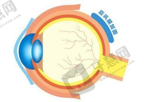 四、武汉眼科医院其他眼科项目价格与白内障手术价格的综合影响
