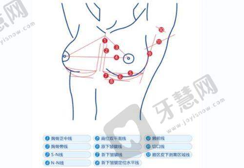 inmode钻石超塑国内哪些店有之广州美莱