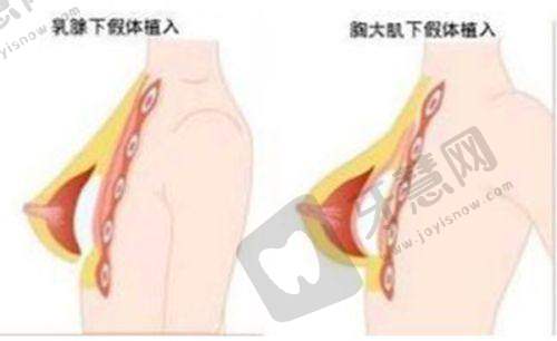 重庆白内障免费政策2025!农村户籍/低保户0元手术,附定点医院——免费项目与费用覆盖