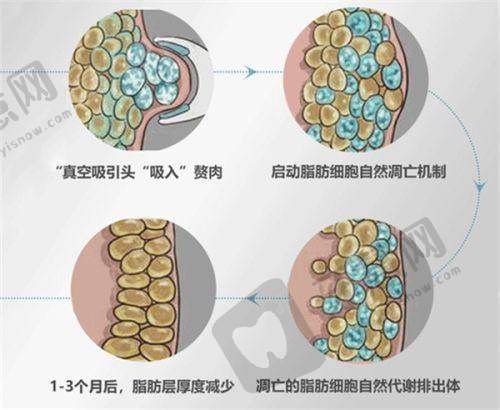 上海魏少魁医生眼修复价格与预约
