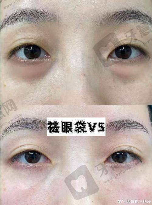 陈曦医生擅长的整形项目有哪些