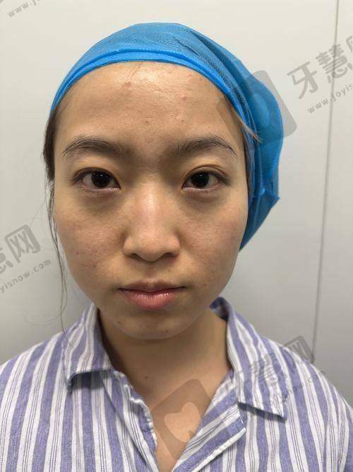 黄志有医生眼部和鼻部整形的技术优势