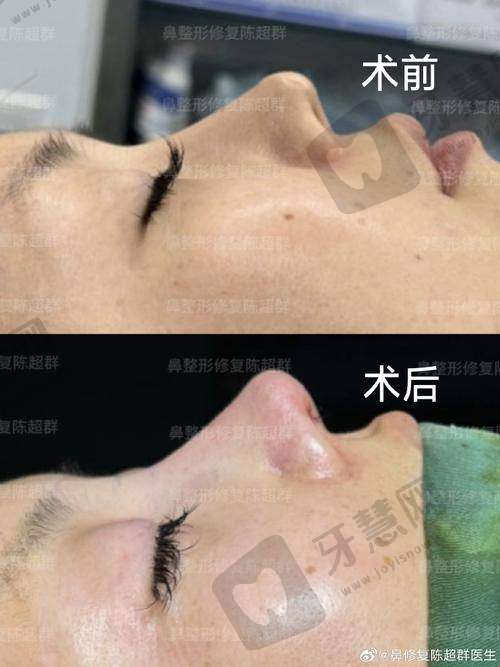 黄旭培医生的坐诊医院信息