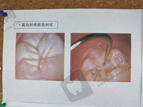 上海松丰口腔悦康门诊部（爱琴海店）收费价格表/收费标准