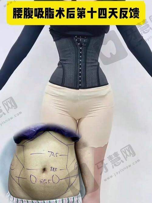 史冰心医生的擅长项目介绍