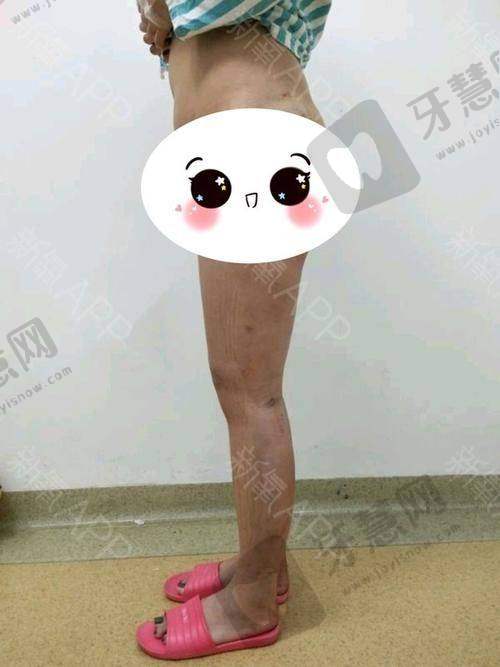 张凯悦医生的擅长项目