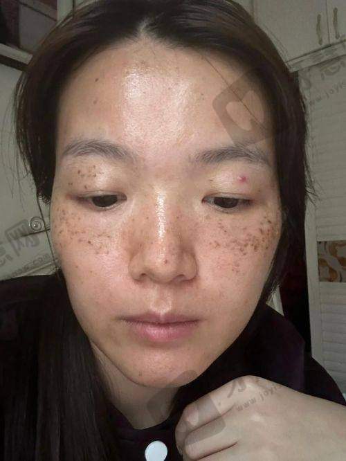 盛纯晶医生的顾客好评实例