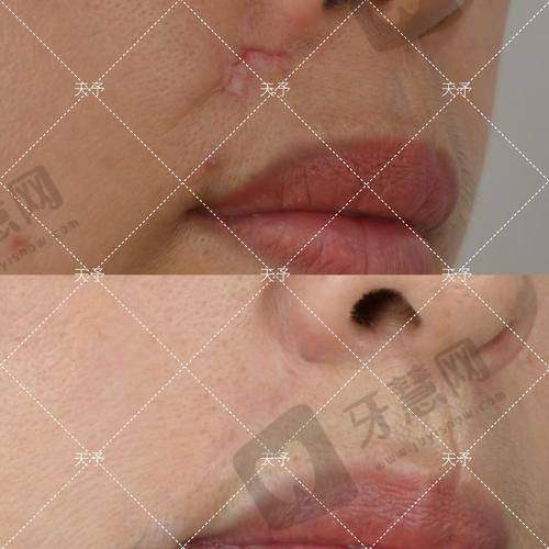 杨廷医生的青岛华韩整形个人资料简介