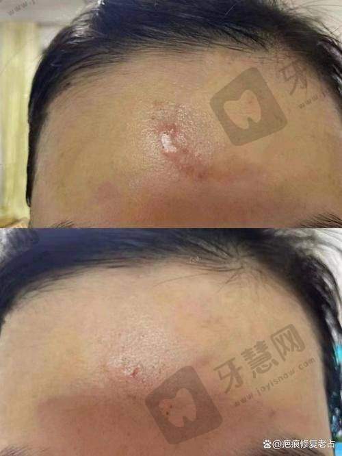 杨廷医生的青岛华韩整形技术优势