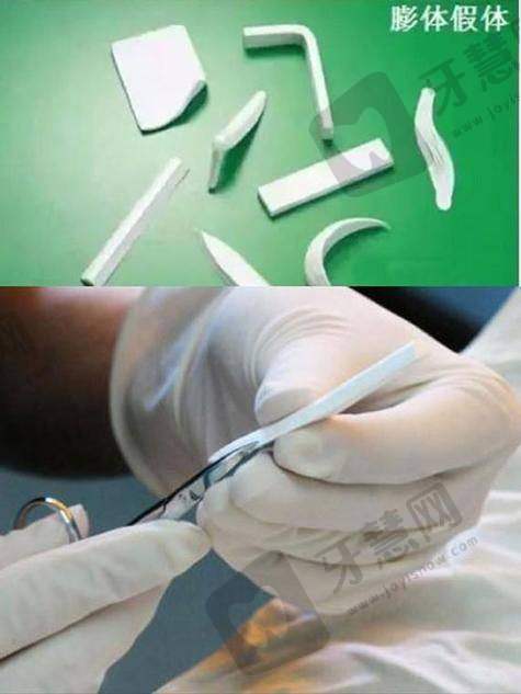 魏少魁医生技术优势