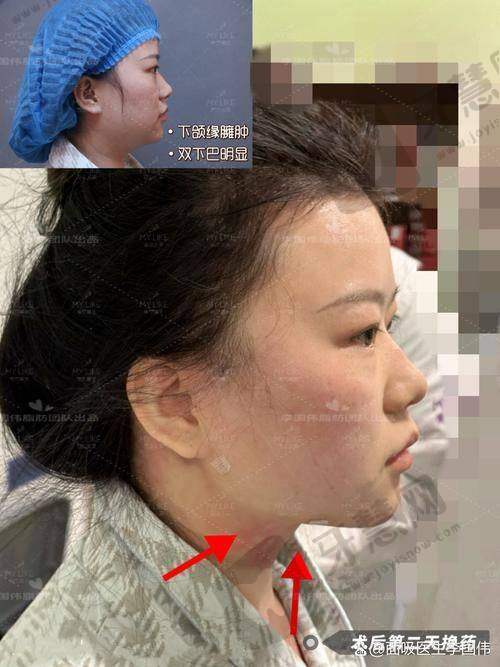 郑州杨丽美颜医疗美容门诊部项目特色