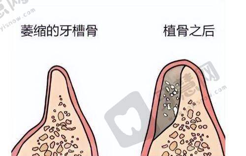 韩国VSLine皮肤科江南店预约攻略：预约有啥建议不？