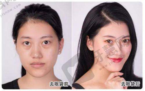 韩国VSLine皮肤科江南店预约攻略：都有啥预约方式呀？