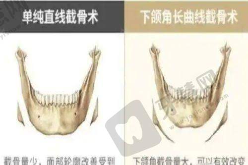 广州米伦整形医院地址电话及营业时间：